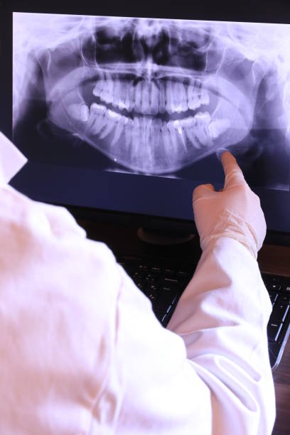 Best Broken or Chipped Tooth Repair in Exandria, AL