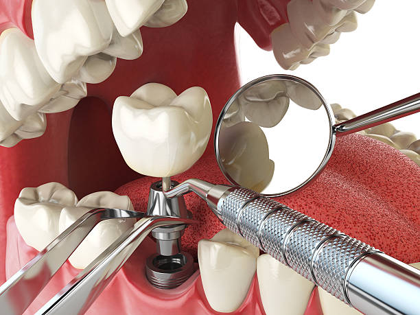 Best 24-Hour Emergency Dental Care in Exandria, AL